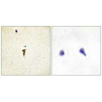 Immunohistochemistry analysis of paraffin-embedded human brain tissue, using ICK antibody.