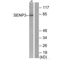 Western blot analysis of extracts from Jurkat cells, using SENP3 antibody.