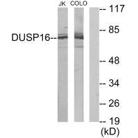 Western blot analysis of extracts from Jurkat cells and COLO205 cells, using DUSP16 antibody.