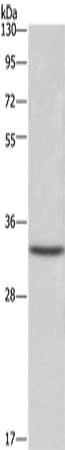 Gel: 8%SDS-PAGE, Lysate: 40 ug, Lane: Hela cells, Primary antibody: CSB-PA278241(CENPH Antibody) at dilution 1/250, Secondary antibody: Goat anti rabbit IgG at 1/8000 dilution, Exposure time: 1 second