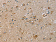 The image on the left is immunohistochemistry of paraffin-embedded Human brain tissue using CSB-PA278505(PAGE2 Antibody) at dilution 1/20, on the right is treated with fusion protein. (Original magnification: ×200)
