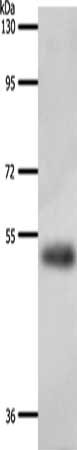 Gel: 8%SDS-PAGE, Lysate: 40 ug, Lane: Human liver cancer tissue, Primary antibody: CSB-PA278727(A1BG Antibody) at dilution 1/200, Secondary antibody: Goat anti rabbit IgG at 1/8000 dilution, Exposure time: 30 minutes