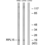 Western blot analysis of extracts from K562 cells and LOVO cells, using RPL15 antibody.