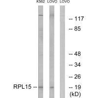 Western blot analysis of extracts from K562 cells and LOVO cells, using RPL15 antibody.