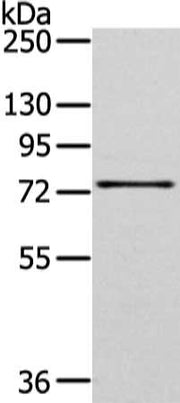 Gel: 6%SDS-PAGE, Lysate: 40 ug, Lane: PC cell, Primary antibody: CSB-PA278805(GHR Antibody) at dilution 1/400 dilution, Secondary antibody: Goat anti rabbit IgG at 1/8000 dilution, Exposure time: 2 minutes