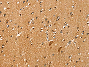 The image on the left is immunohistochemistry of paraffin-embedded Human brain tissue using CSB-PA278926(SLC16A3 Antibody) at dilution 1/20, on the right is treated with synthetic peptide. (Original magnification: ×200)