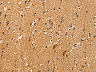 The image on the left is immunohistochemistry of paraffin-embedded Human brain tissue using CSB-PA278926(SLC16A3 Antibody) at dilution 1/20, on the right is treated with synthetic peptide. (Original magnification: ×200)