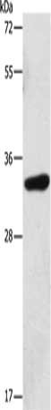 Gel: 12%SDS-PAGE, Lysate: 40 ug, Lane: Human testis tissue, Primary antibody: CSB-PA279059(MAGEA3 Antibody) at dilution 1/325, Secondary antibody: Goat anti rabbit IgG at 1/8000 dilution, Exposure time: 40 seconds