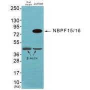 Western blot analysis of extracts from JK cells, using NBPF1/9/10/12/14/15/16/20 antibody.