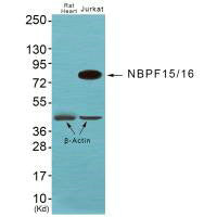 Western blot analysis of extracts from JK cells, using NBPF1/9/10/12/14/15/16/20 antibody.