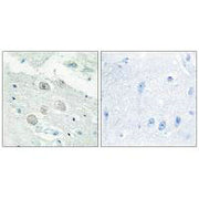 Immunohistochemistry analysis of paraffin-embedded human brain tissue, using JAK1 antibody.