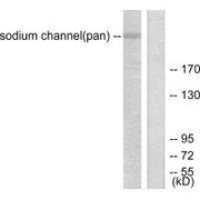 Western blot analysis of extracts from HuvEc cells, using Sodium Channel-pan antibody.