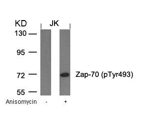 Western blot analysis of extracts from JK cells untreated or treated with anisomycin using Zap-70(Phospho-Tyr493) Antibody.