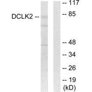 Western blot analysis of extracts from HepG2 cells, using DCLK2 antibody.