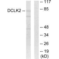 Western blot analysis of extracts from HepG2 cells, using DCLK2 antibody.