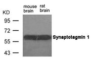 Western blot analysis of extracts from mouse brain and rat brain tissue using Synaptotagmin 1 (Ab-309) Antibody.