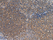 The image on the left is immunohistochemistry of paraffin-embedded Human tonsil tissue using CSB-PA281135(FST Antibody) at dilution 1/35, on the right is treated with synthetic peptide. (Original magnification: ×200)