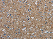 The image on the left is immunohistochemistry of paraffin-embedded Human brain tissue using CSB-PA281298(PGLYRP1 Antibody) at dilution 1/40, on the right is treated with synthetic peptide. (Original magnification: ×200)