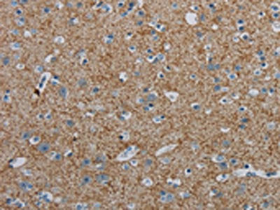 The image on the left is immunohistochemistry of paraffin-embedded Human brain tissue using CSB-PA281298(PGLYRP1 Antibody) at dilution 1/40, on the right is treated with synthetic peptide. (Original magnification: ×200)
