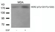 Western blot analysis of extracts from MDA cells untreated or treated with EGF using HER2(Phospho-Tyr1221/Tyr1222) Antibody.