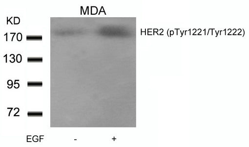 Western blot analysis of extracts from MDA cells untreated or treated with EGF using HER2(Phospho-Tyr1221/Tyr1222) Antibody.