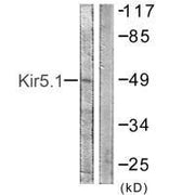 Western blot analysis of extracts from HeLa cells, using Kir5.1 (Ab-416) antibody.