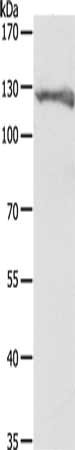 Gel: 8%SDS-PAGE, Lysate: 40 ug, Lane: Hela cells, Primary antibody: CSB-PA281482(PC Antibody) at dilution 1/200, Secondary antibody: Goat anti rabbit IgG at 1/8000 dilution, Exposure time: 30 seconds