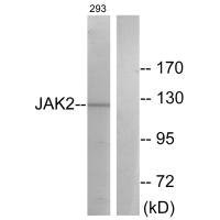 Western blot analysis of extracts from 293 cells, treated with etoposide (25uM, 24hours), using JAK2 (Ab-570) antibody.