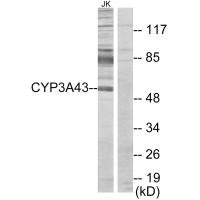Western blot analysis of extracts from Jurkat cells, using Cytochrome P450 3A43 antibody.
