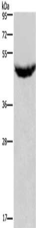 Gel: 8%SDS-PAGE, Lysate: 40 ug, Lane: Human serum, Primary antibody: CSB-PA282080(CXCR2 Antibody) at dilution 1/125, Secondary antibody: Goat anti rabbit IgG at 1/8000 dilution, Exposure time: 2 minutes