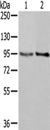 Gel: 6%SDS-PAGE,Lysate: 40 ug,Lane 1-2: Hela cells, K562 cells,Primary antibody: CSB-PA282096(NUP98 Antibody) at dilution 1/350 dilution,Secondary antibody: Goat anti rabbit IgG at 1/8000 dilution,Exposure time: 1 minute