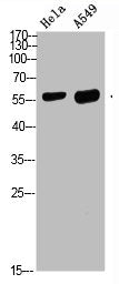 Western blot analysis of HELA A549 Cell Lysate, antibody was diluted at 1:1000. Secondary antibody was diluted at 1:20000