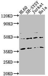 Western Blot Positive WB detected in: HL60 whole cell lysate, SH-SY5Y whole cell lysate, Jurkat whole cell lysate, Hela whole cell lysate All lanes: CASTOR2 antibody at 1:2000 Secondary Goat polyclonal to rabbit IgG at 1/50000 dilution Predicted b...
