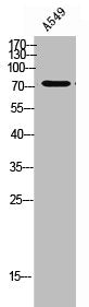 Western Blot analysis of A549 cells using PDE10A Polyclonal Antibody