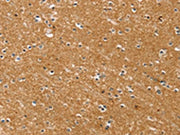 The image on the left is immunohistochemistry of paraffin-embedded Human brain tissue using CSB-PA282582(SYTL5 Antibody) at dilution 1/50, on the right is treated with fusion protein. (Original magnification: ×200)