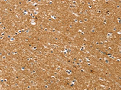 The image on the left is immunohistochemistry of paraffin-embedded Human brain tissue using CSB-PA282582(SYTL5 Antibody) at dilution 1/50, on the right is treated with fusion protein. (Original magnification: ×200)