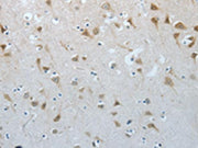 The image on the left is immunohistochemistry of paraffin-embedded Human brain tissue using CSB-PA282680(MUC20 Antibody) at dilution 1/20, on the right is treated with fusion protein. (Original magnification: ×200)