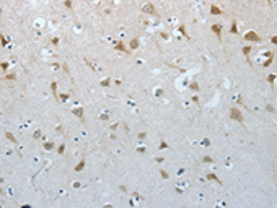 The image on the left is immunohistochemistry of paraffin-embedded Human brain tissue using CSB-PA282680(MUC20 Antibody) at dilution 1/20, on the right is treated with fusion protein. (Original magnification: ×200)