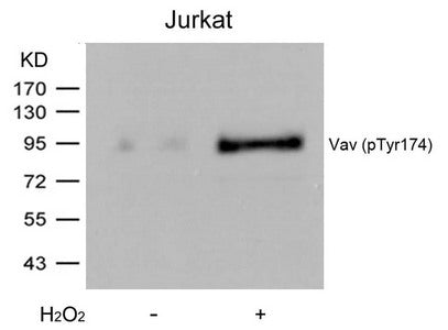 Western blot analysis of extracts from Jurkat cells untreated or treated with H2O2 using Vav(Phospho-Tyr174) Antibody.