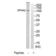 Western blot analysis of extracts from COLO205 and Jurkat cells, using EPHA2 antibody.