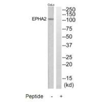 Western blot analysis of extracts from COLO205 and Jurkat cells, using EPHA2 antibody.