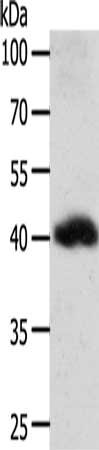 Gel: 10%SDS-PAGE, Lysate: 50 ug, Lane: A549 cells, Primary antibody: CSB-PA283200(WNT9A Antibody) at dilution 1/200, Secondary antibody: Goat anti rabbit IgG at 1/8000 dilution, Exposure time: 1 minute
