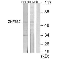 Western blot analysis of extracts from COLO205 cells and HUVEC cells, using ZNF682 antibody.