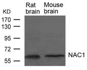 Western blot analysis of extracts from Rat and Mouse brain tissue using NAC1 Antibody.