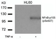 Western blot analysis of extracts from HL60 cells untreated or treated with TNF-a using NFkB-p105(Phospho-Ser927) Antibody.