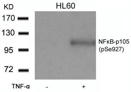 Western blot analysis of extracts from HL60 cells untreated or treated with TNF-a using NFkB-p105(Phospho-Ser927) Antibody.
