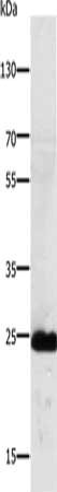 Gel: 10%SDS-PAGE, Lysate: 30 ug, Lane: Mouse lung tissue, Primary antibody: CSB-PA283609(RALB Antibody) at dilution 1/250, Secondary antibody: Goat anti rabbit IgG at 1/8000 dilution, Exposure time: 30 seconds