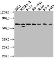 Western Blot Positive WB detected in: U251 whole cell lysate, NTERA-2 whole cell lysate, Hela whole cell lysate, SH-SY5Y whole cell lysate, HL60 whole cell lysate, PC-3 whole cell lysate, A549 whole cell lysate All lanes: CDK17 antibody at 1:2000...