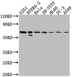 Western Blot Positive WB detected in: U251 whole cell lysate, NTERA-2 whole cell lysate, Hela whole cell lysate, SH-SY5Y whole cell lysate, HL60 whole cell lysate, PC-3 whole cell lysate, A549 whole cell lysate All lanes: CDK17 antibody at 1:2000...