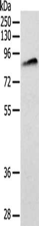 Gel: 10%SDS-PAGE, Lysate: 40 ug, Lane: Lovo cells, Primary antibody: CSB-PA283852(ANTXR1 Antibody) at dilution 1/200, Secondary antibody: Goat anti rabbit IgG at 1/8000 dilution, Exposure time: 2 minutes